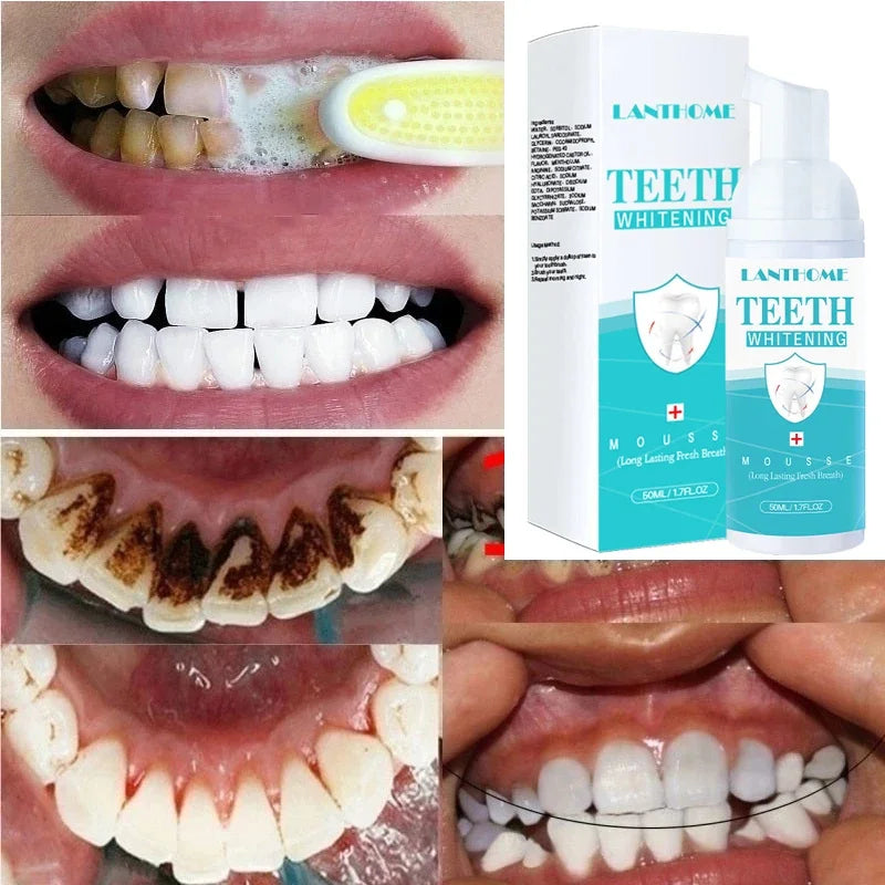 Teeth Whitening Foam Mousse Toothpaste Remove Plaque Stains Oral Hygiene Cleaning Bleaching Fresh Bad Breath Dental Tools Care